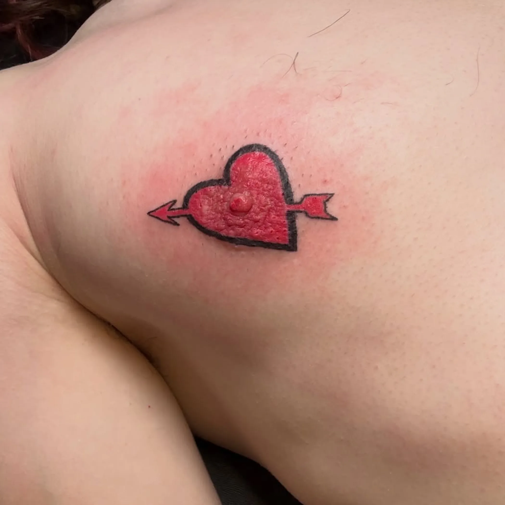 areola tattooing procedure